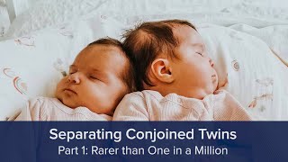 Separating Conjoined Twins Part 1 Rarer than One in a Million [upl. by Selec]