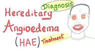 Hereditary Angioedema HAE  Quick Review  Emergency Medicine [upl. by Enined671]