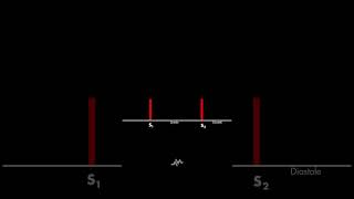 Normal Heart Sounds [upl. by Rather789]