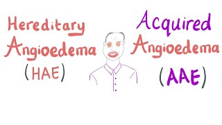 Angioedema  Symptoms Signs and Causes [upl. by Gurolinick49]