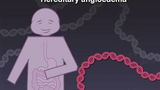 Treating Hereditary Angioedema [upl. by Humfrid]